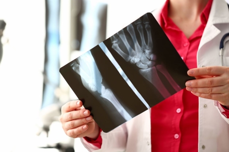 radiologist holding x-ray film image against hospital office background